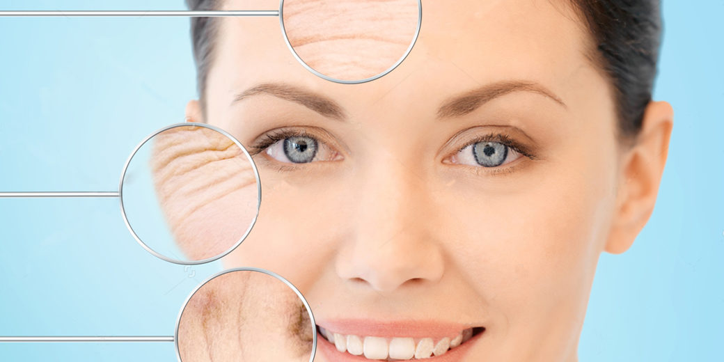 lipolfilling-mc-gooi