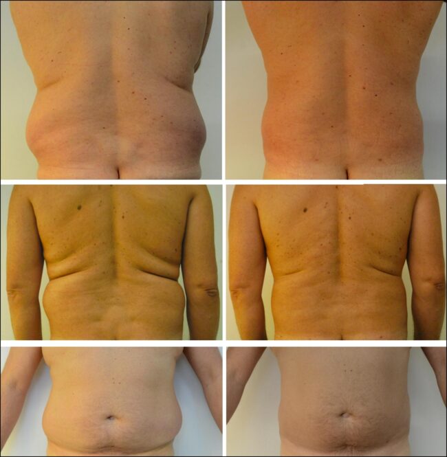 Love-handles-mcgooi-2