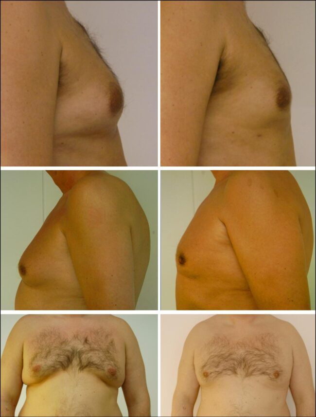 mannenborsten-mcgooi-2-